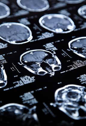 The cognitive edge